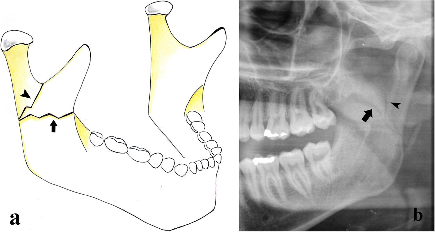 Fig. 6