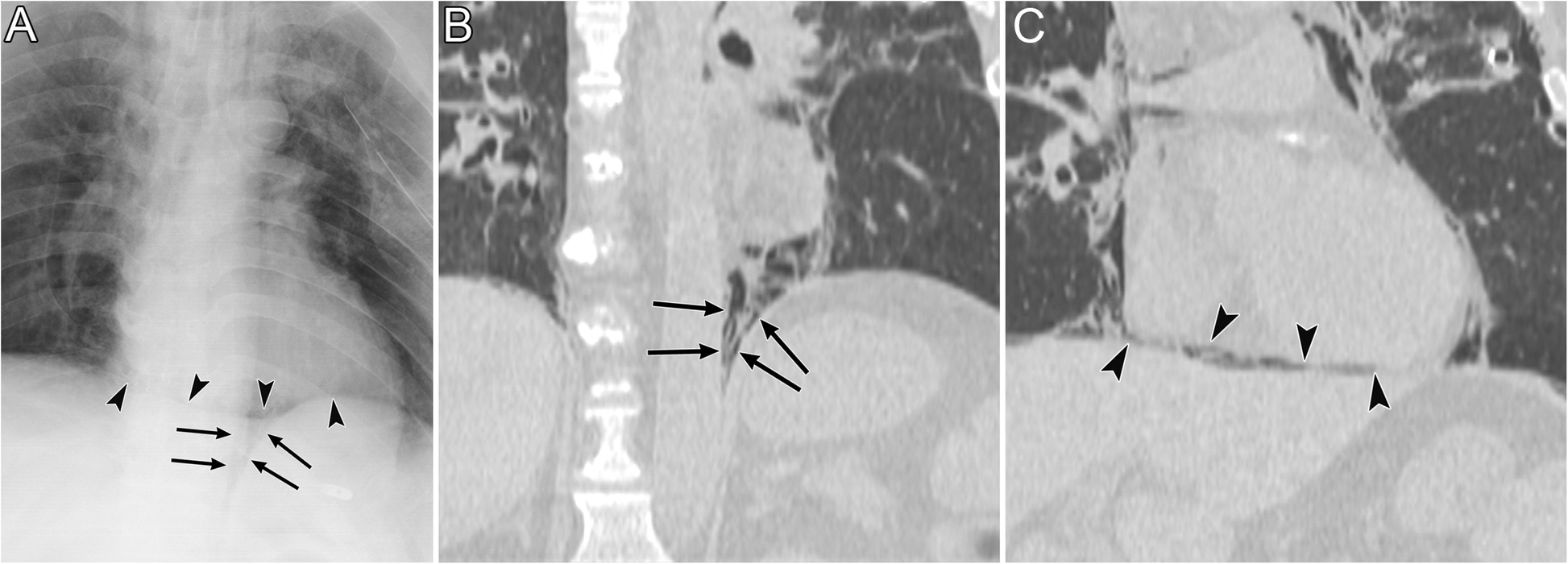 Fig. 16