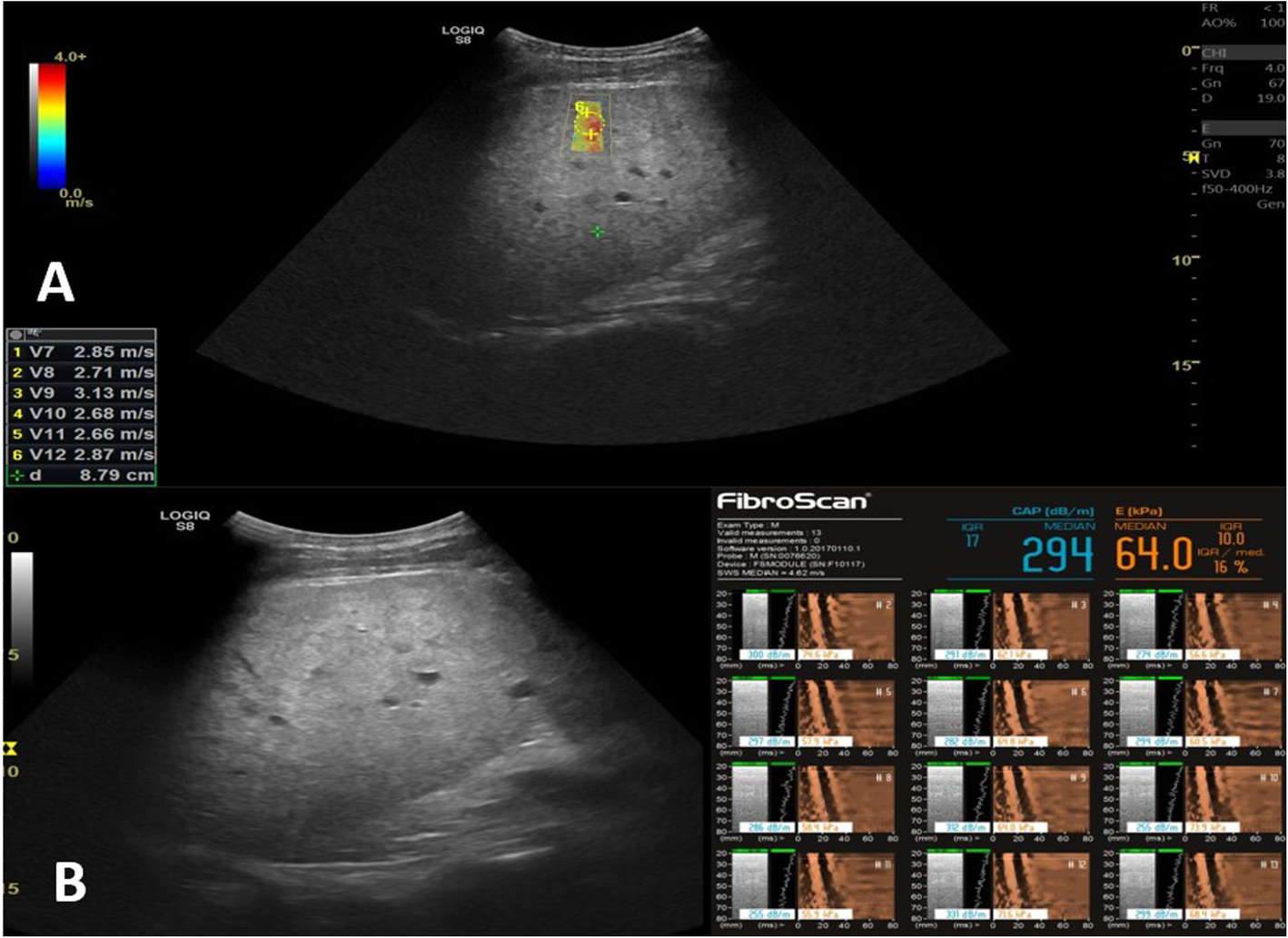 Fig. 4