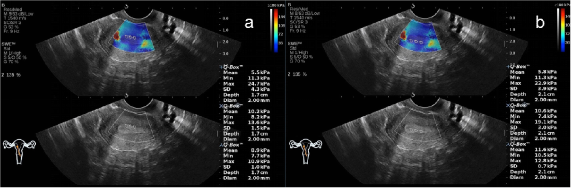 Fig. 3