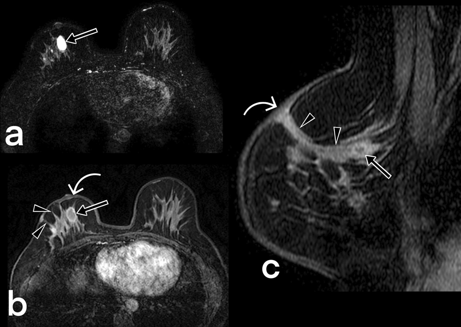 Fig. 12