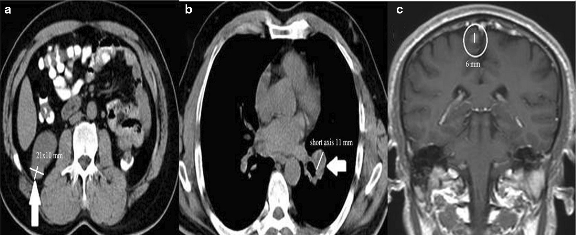 Fig. 6.