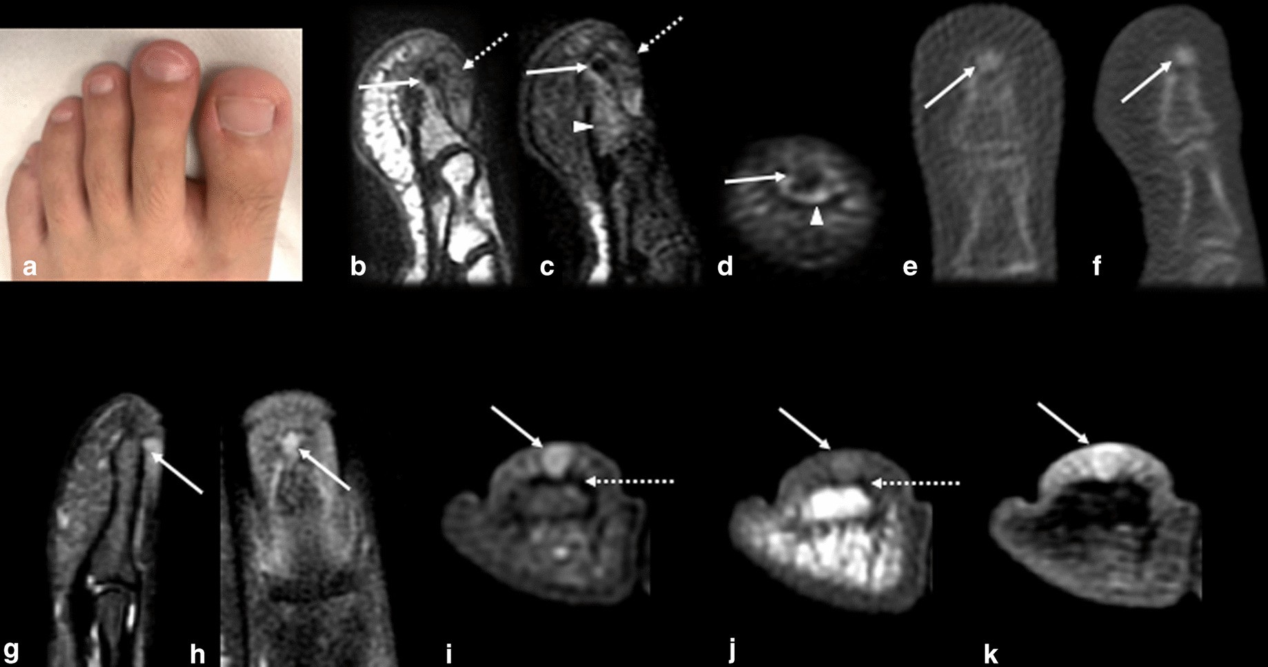 Fig. 14