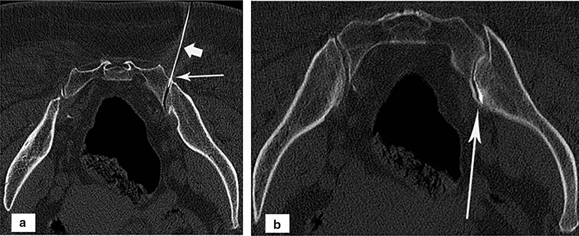 Fig. 3