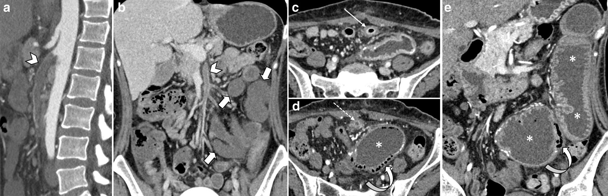 Fig. 11