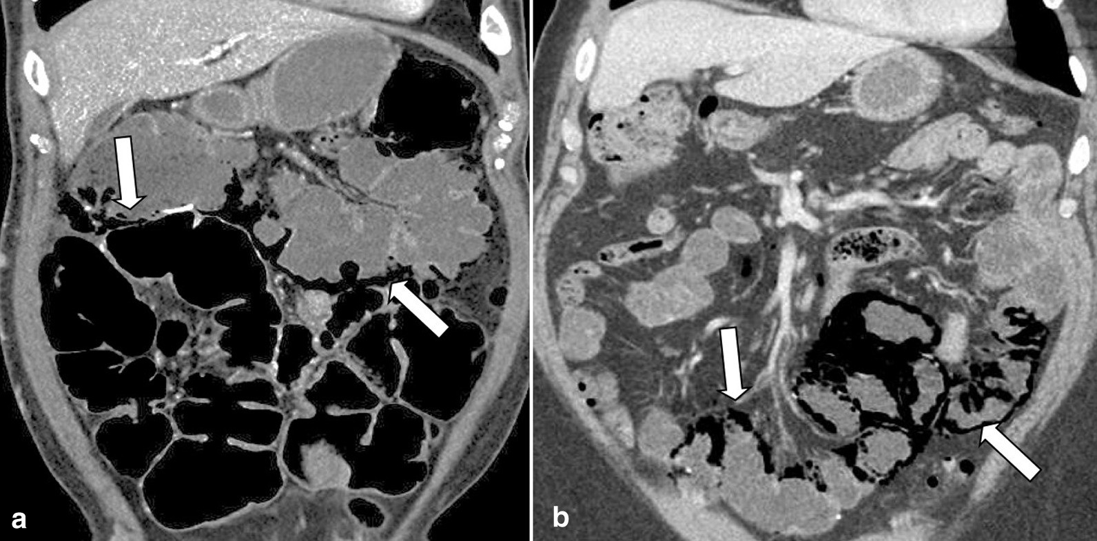 Fig. 31