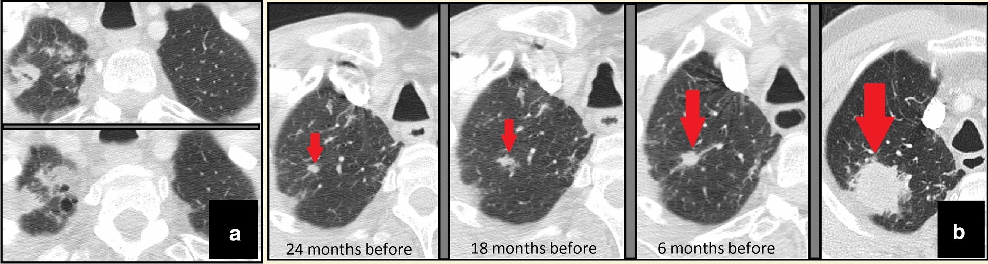 Fig. 10