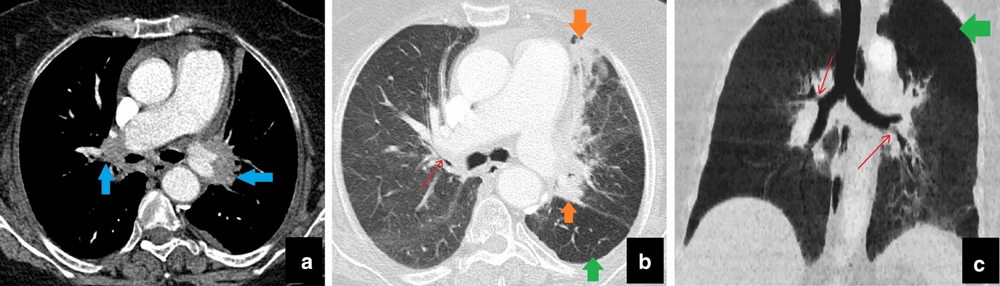 Fig. 11