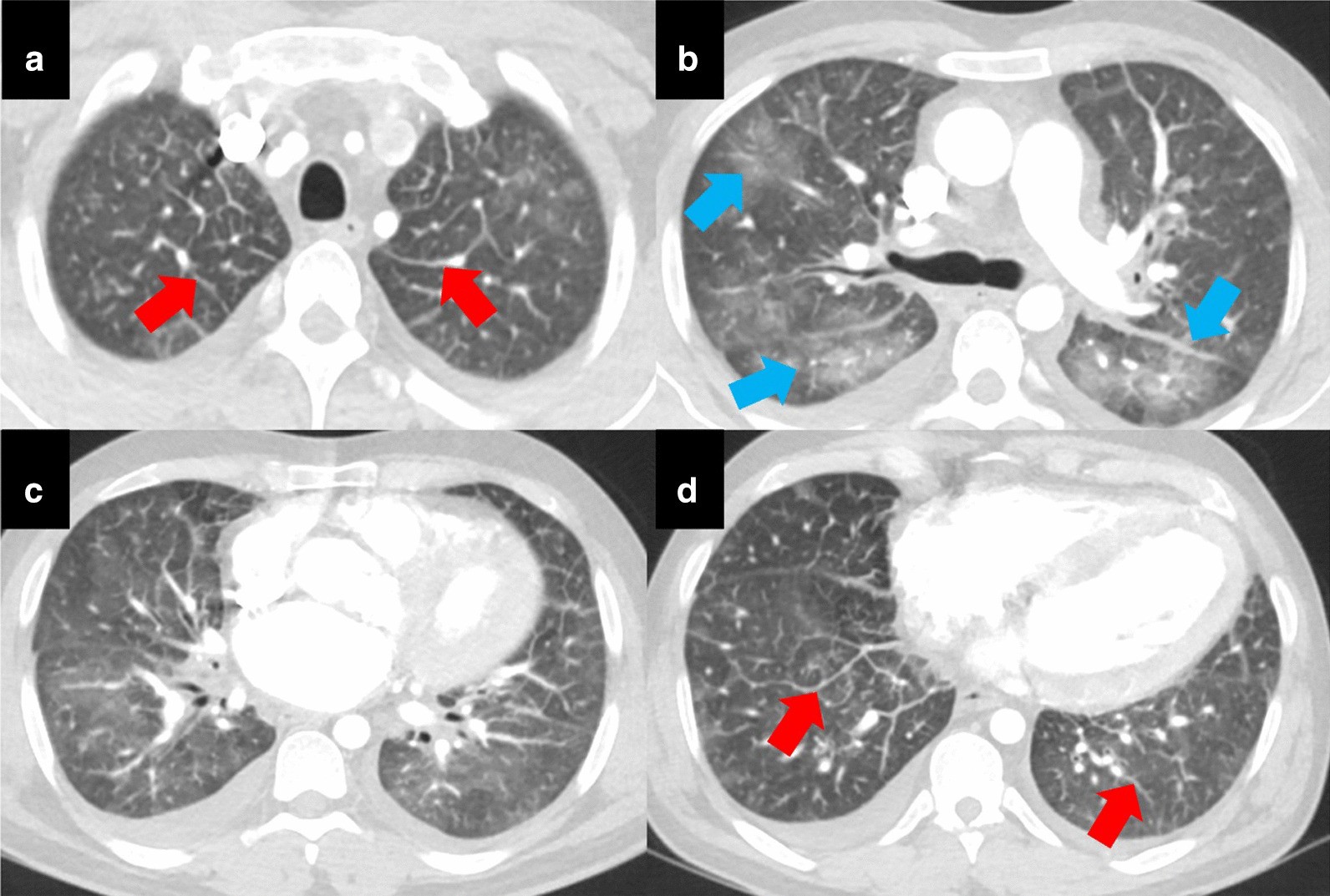 Fig. 16