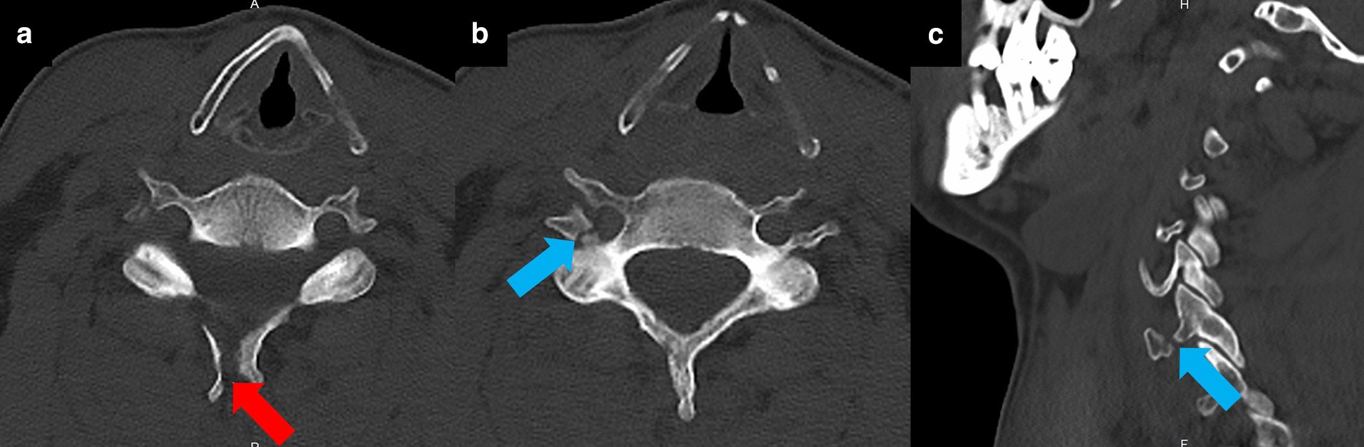 Fig. 1 