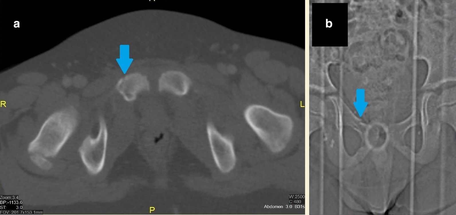 Fig. 20