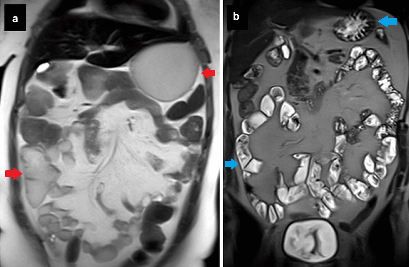 Fig. 21