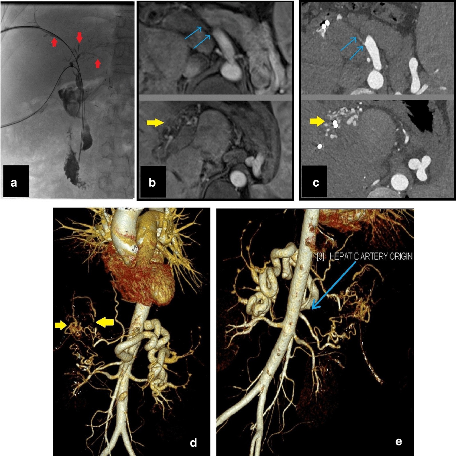 Fig. 22