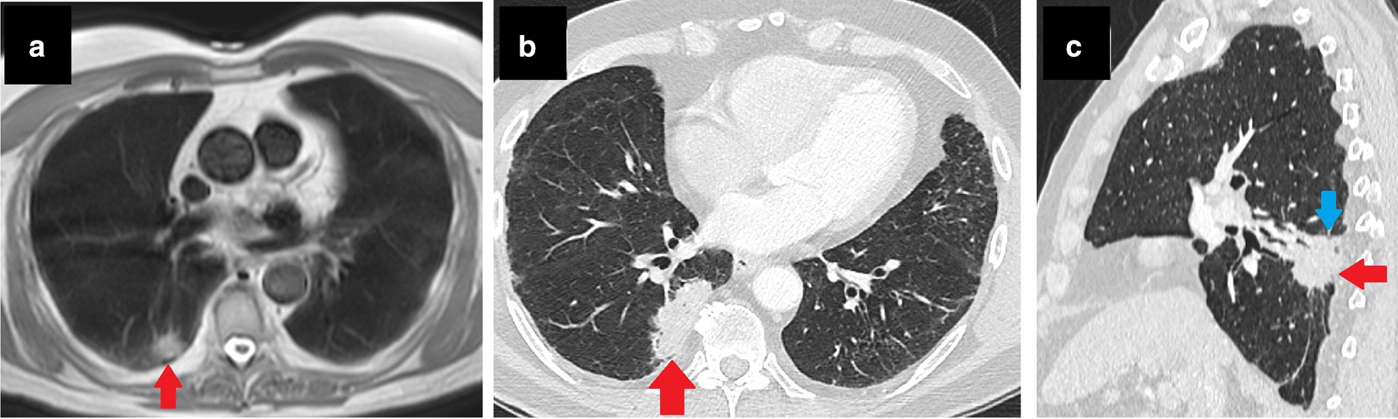 Fig. 23