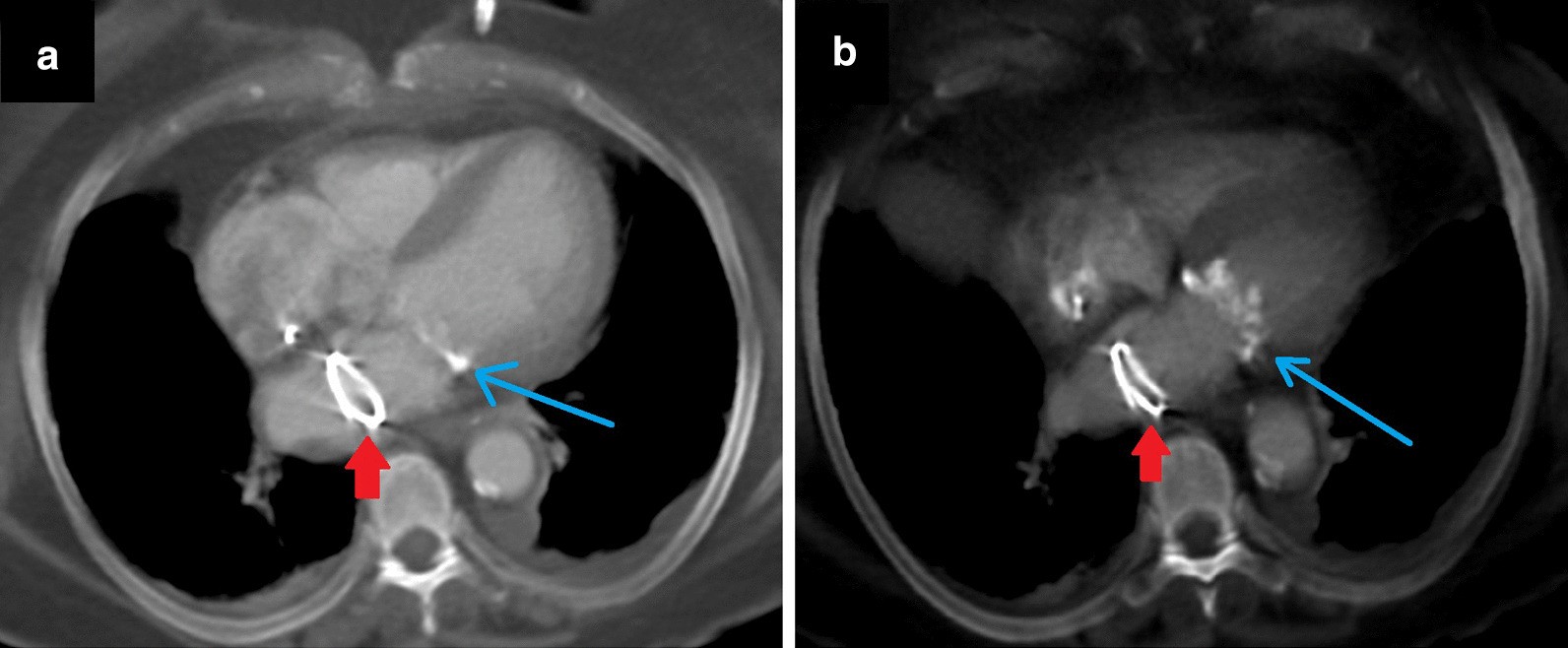 Fig. 25