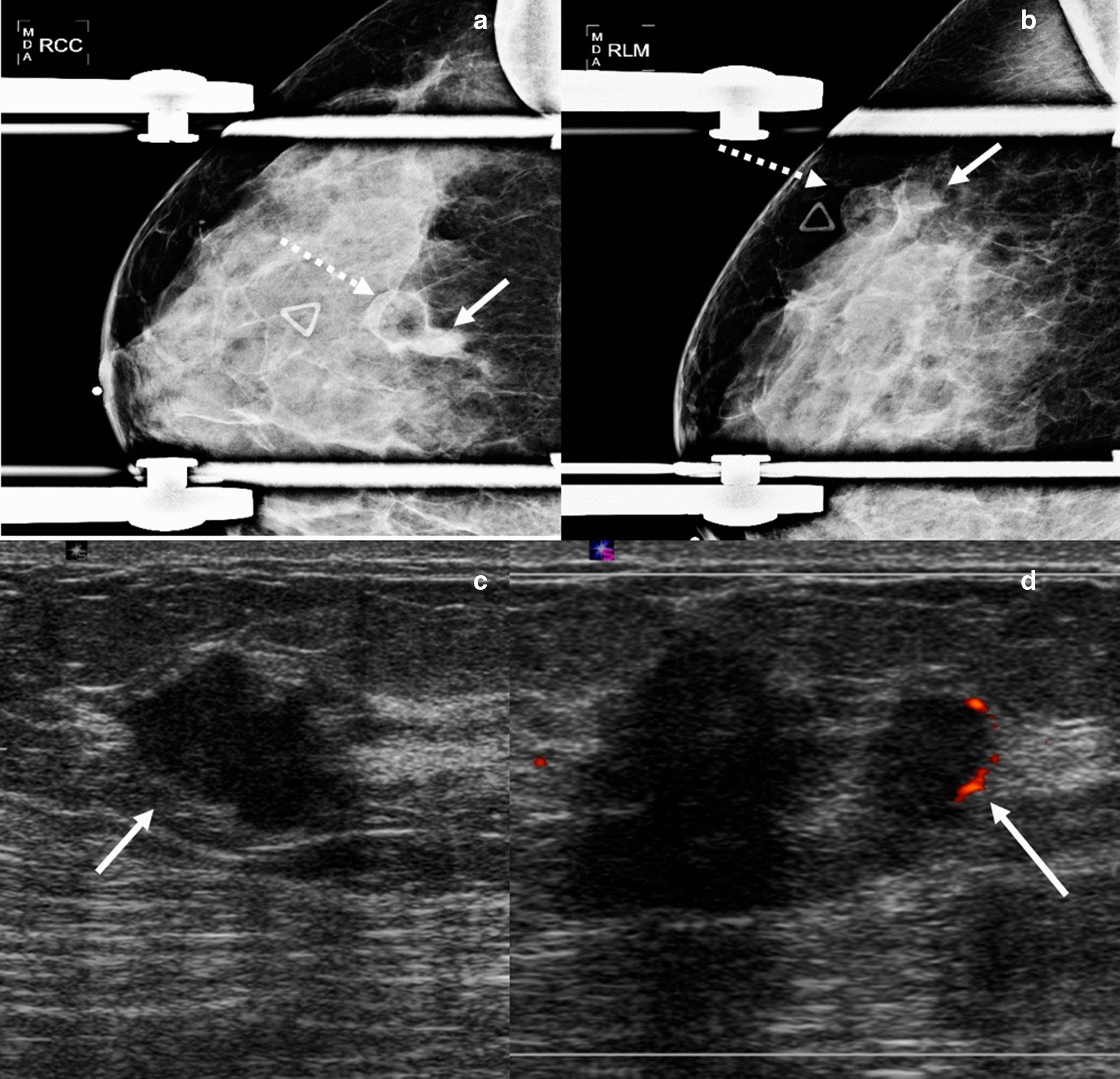 Fig. 13