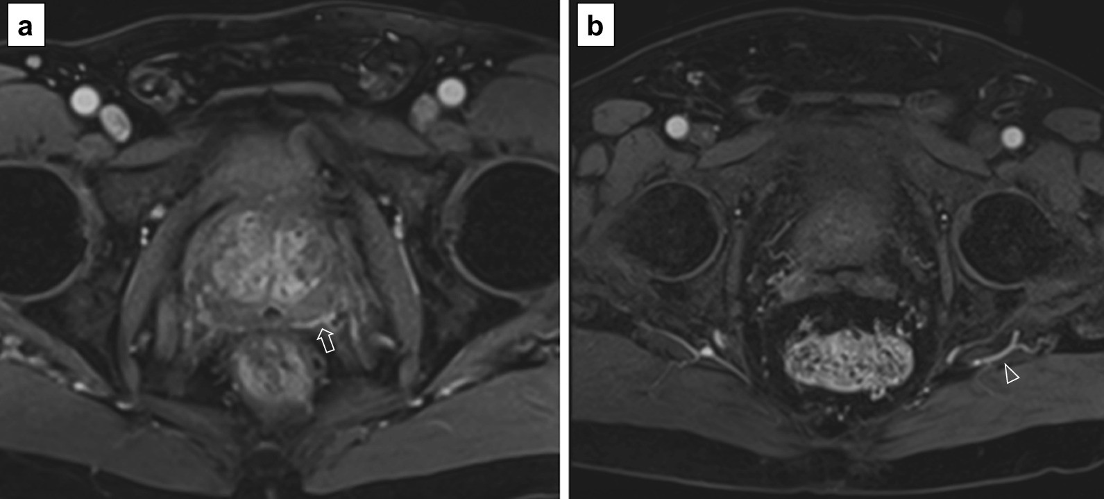 Fig. 20