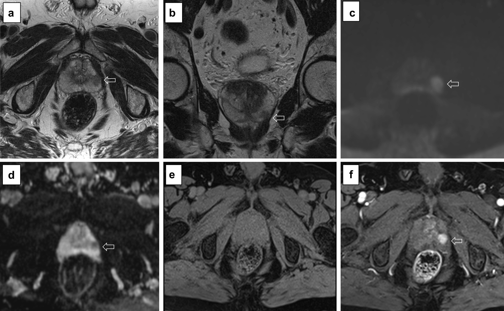 Fig. 25