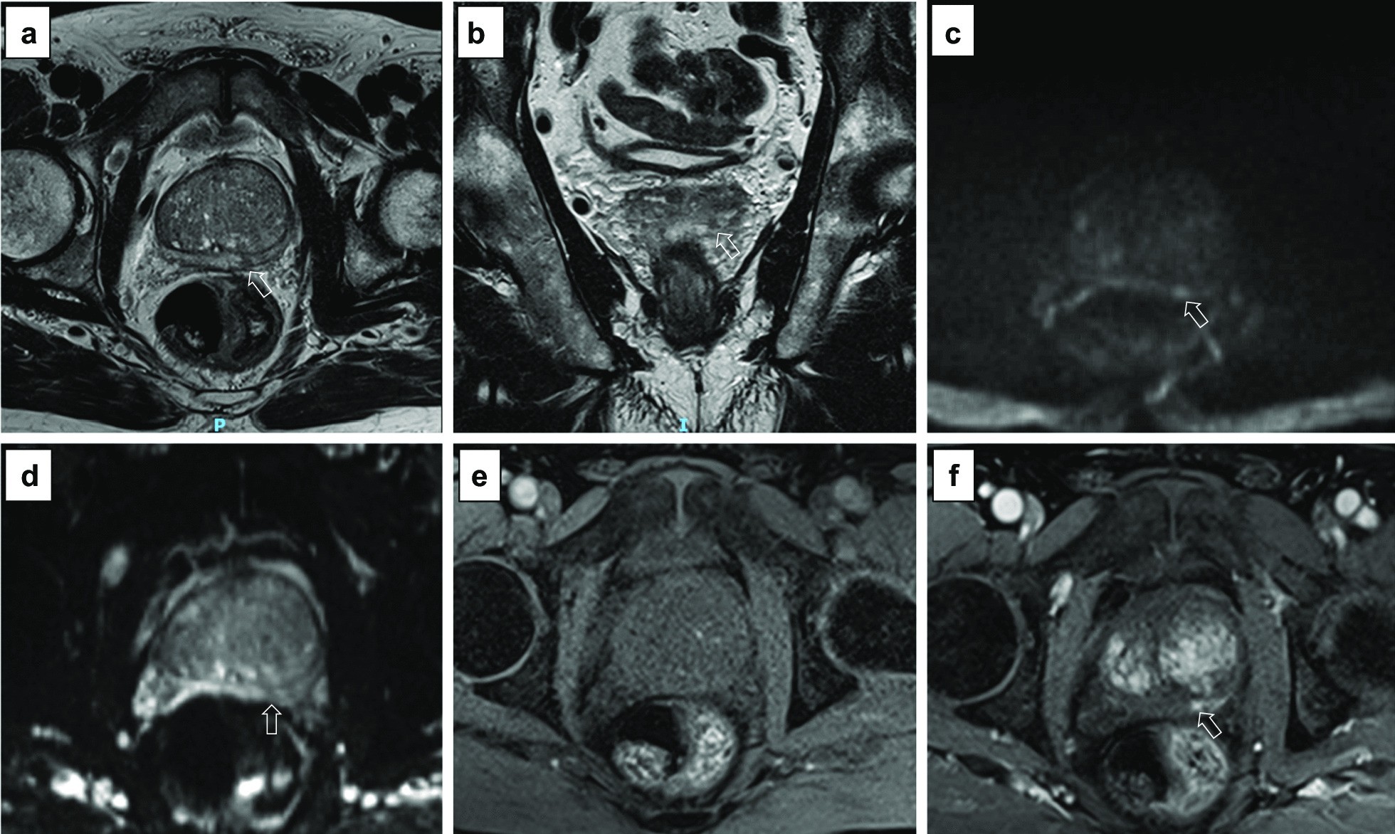 Fig. 26