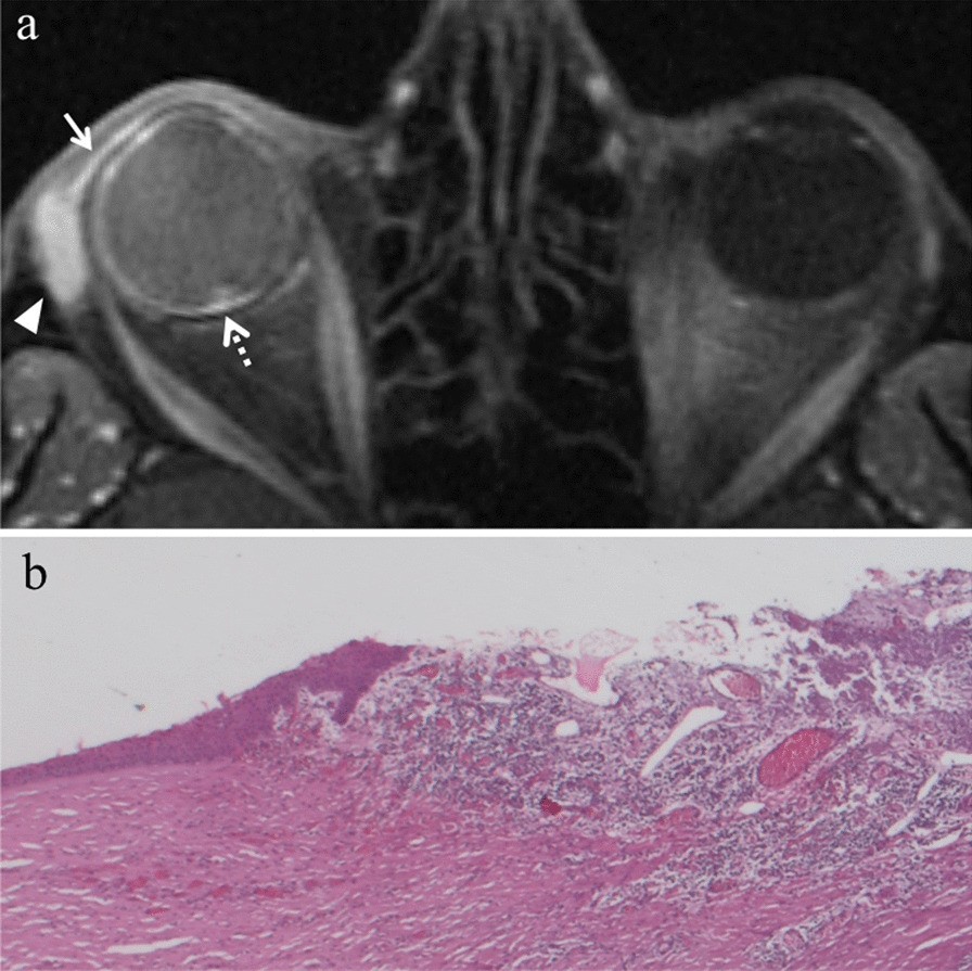 Fig. 10