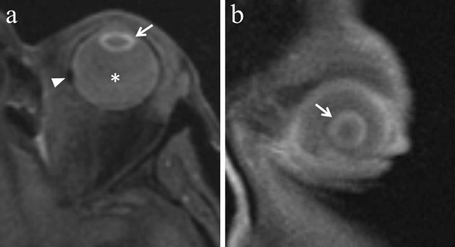 Fig. 11