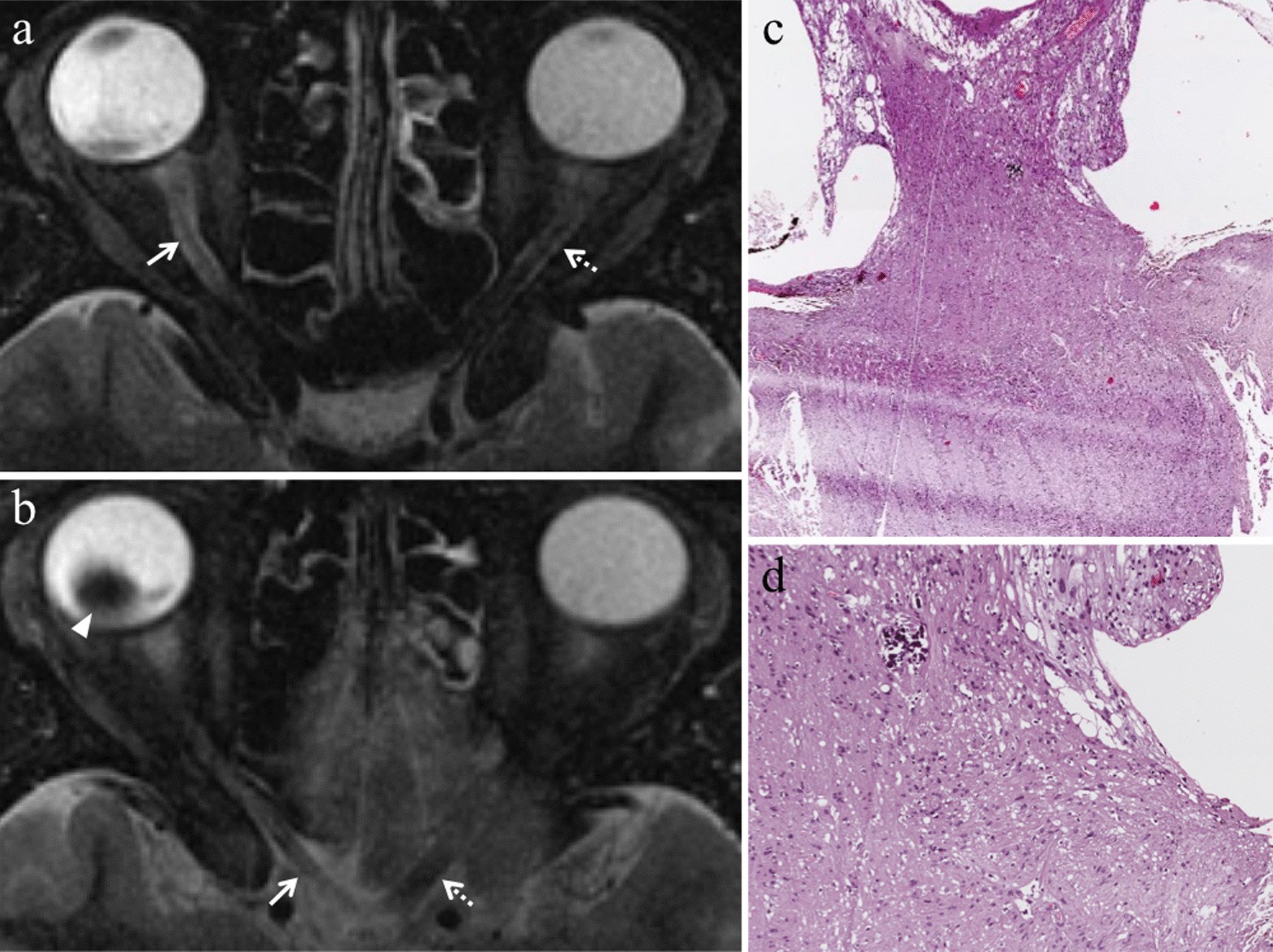 Fig. 14