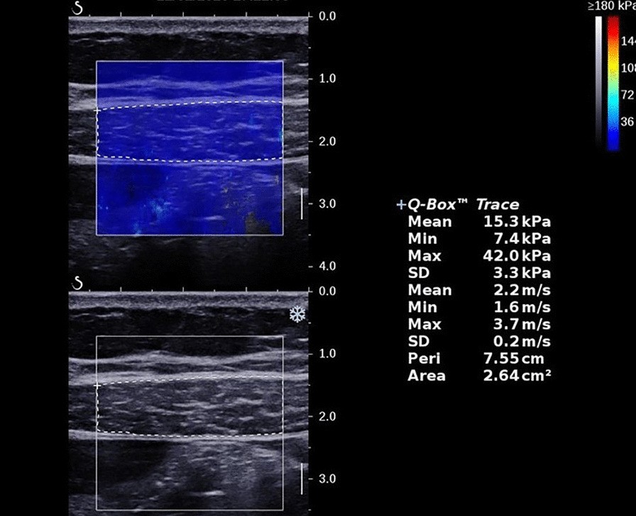 Fig. 4