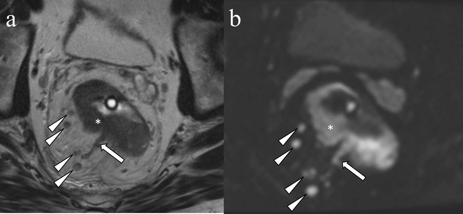 Fig. 11