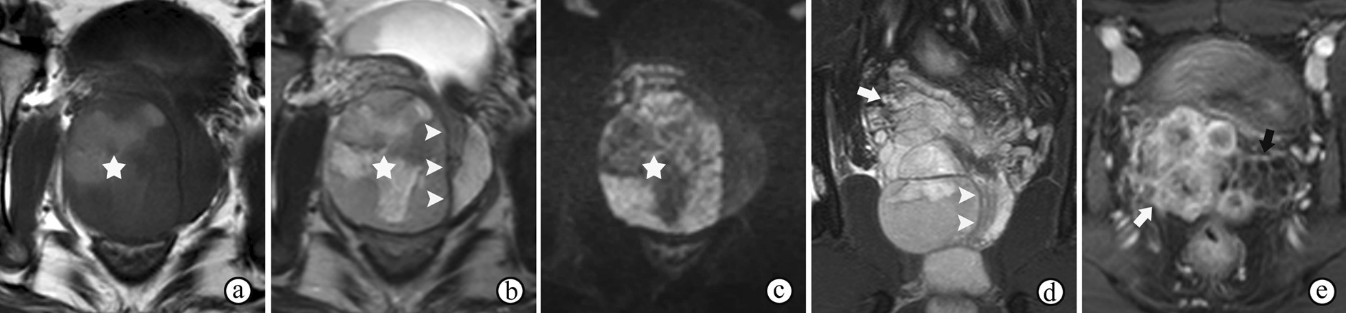 Fig. 14