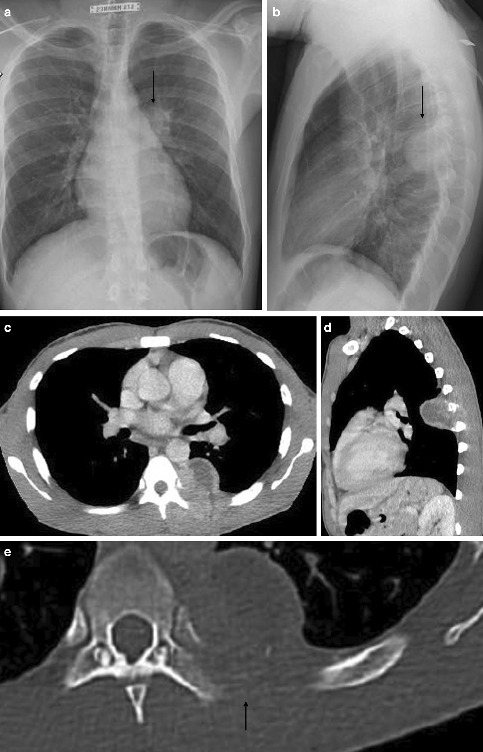 Fig. 17