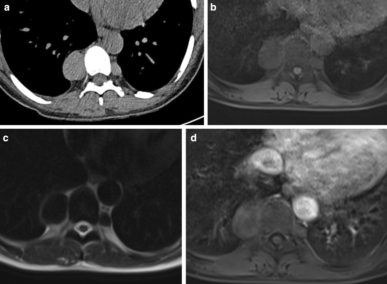 Fig. 20