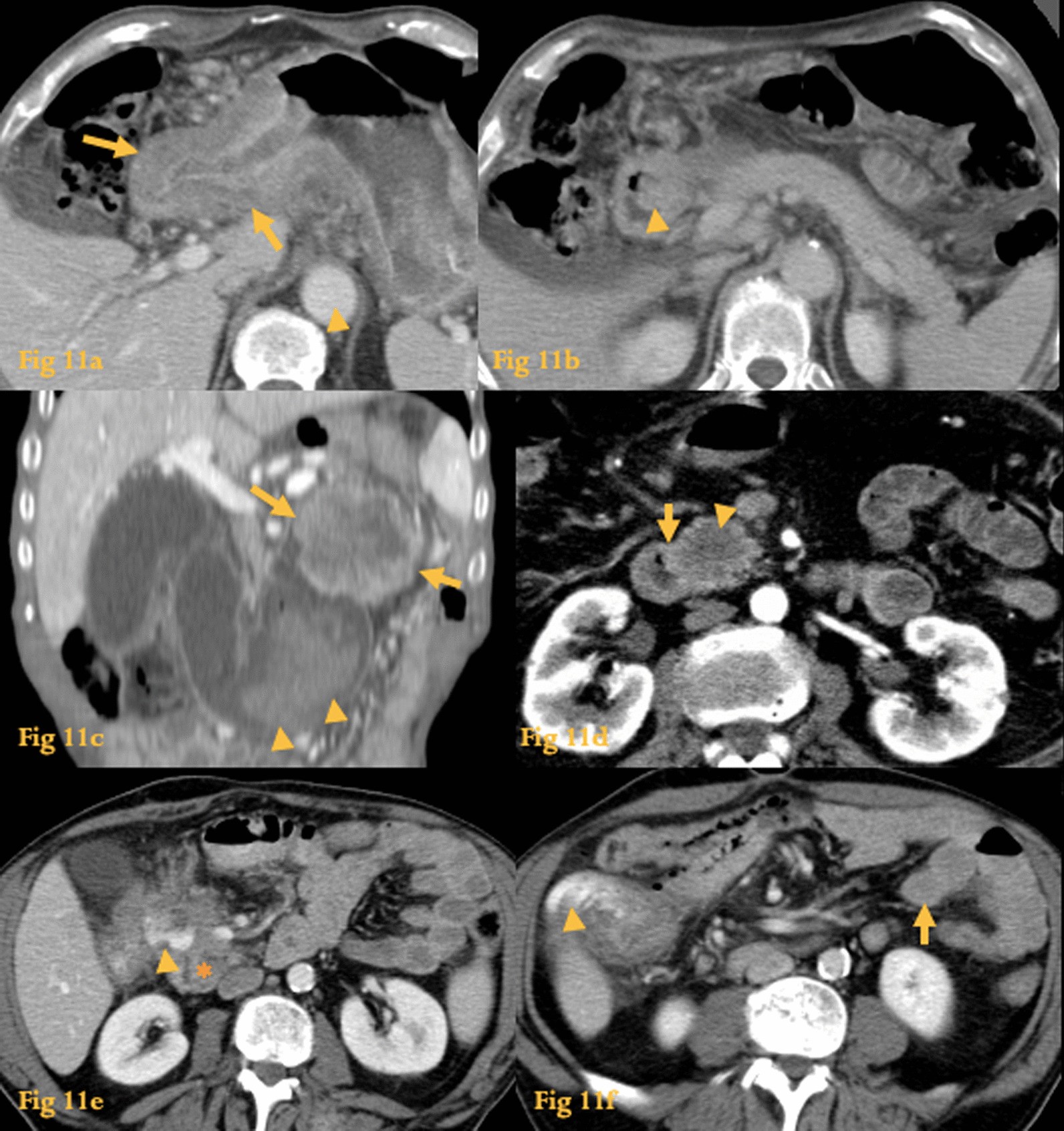 Fig. 11