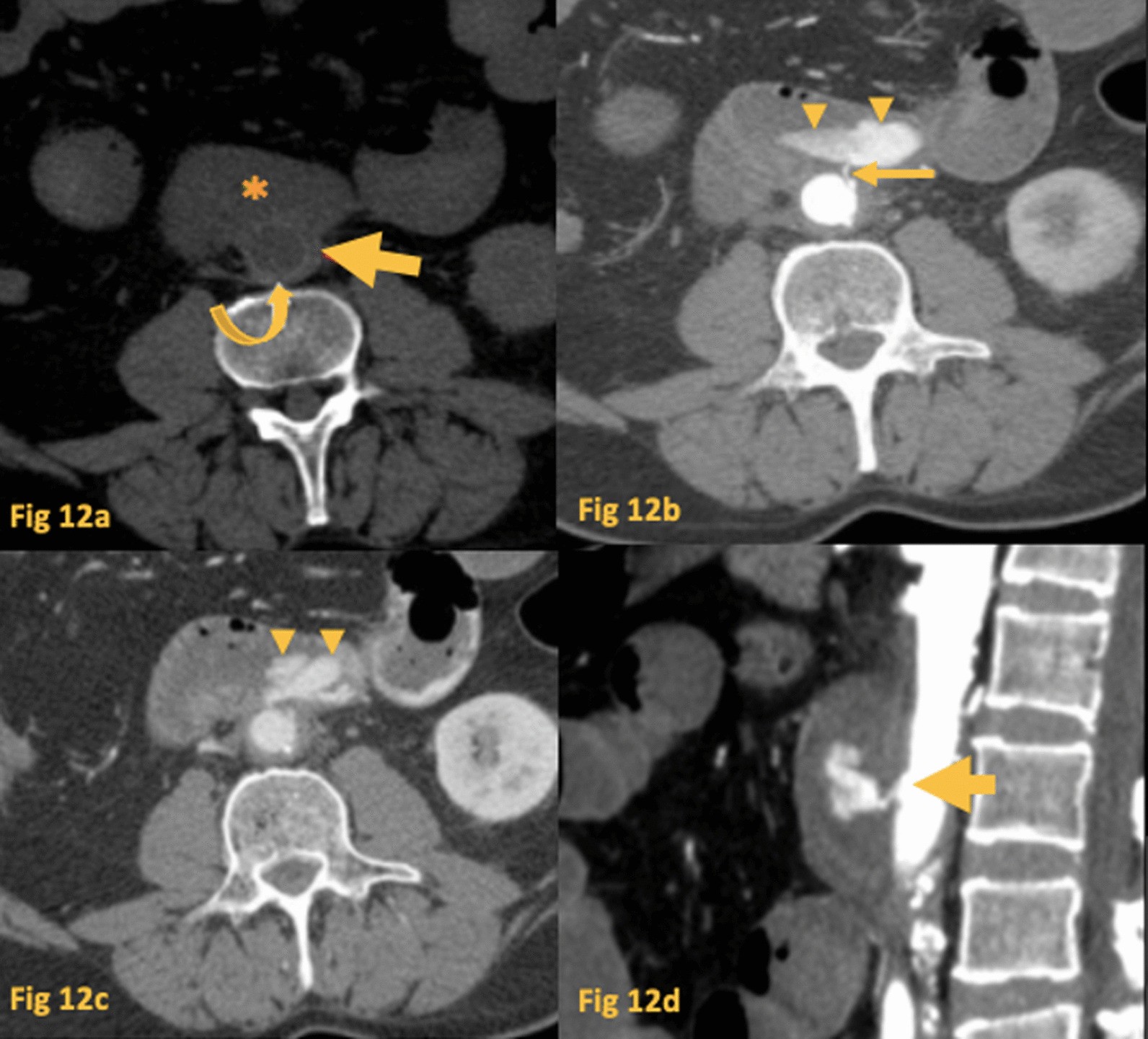 Fig. 12