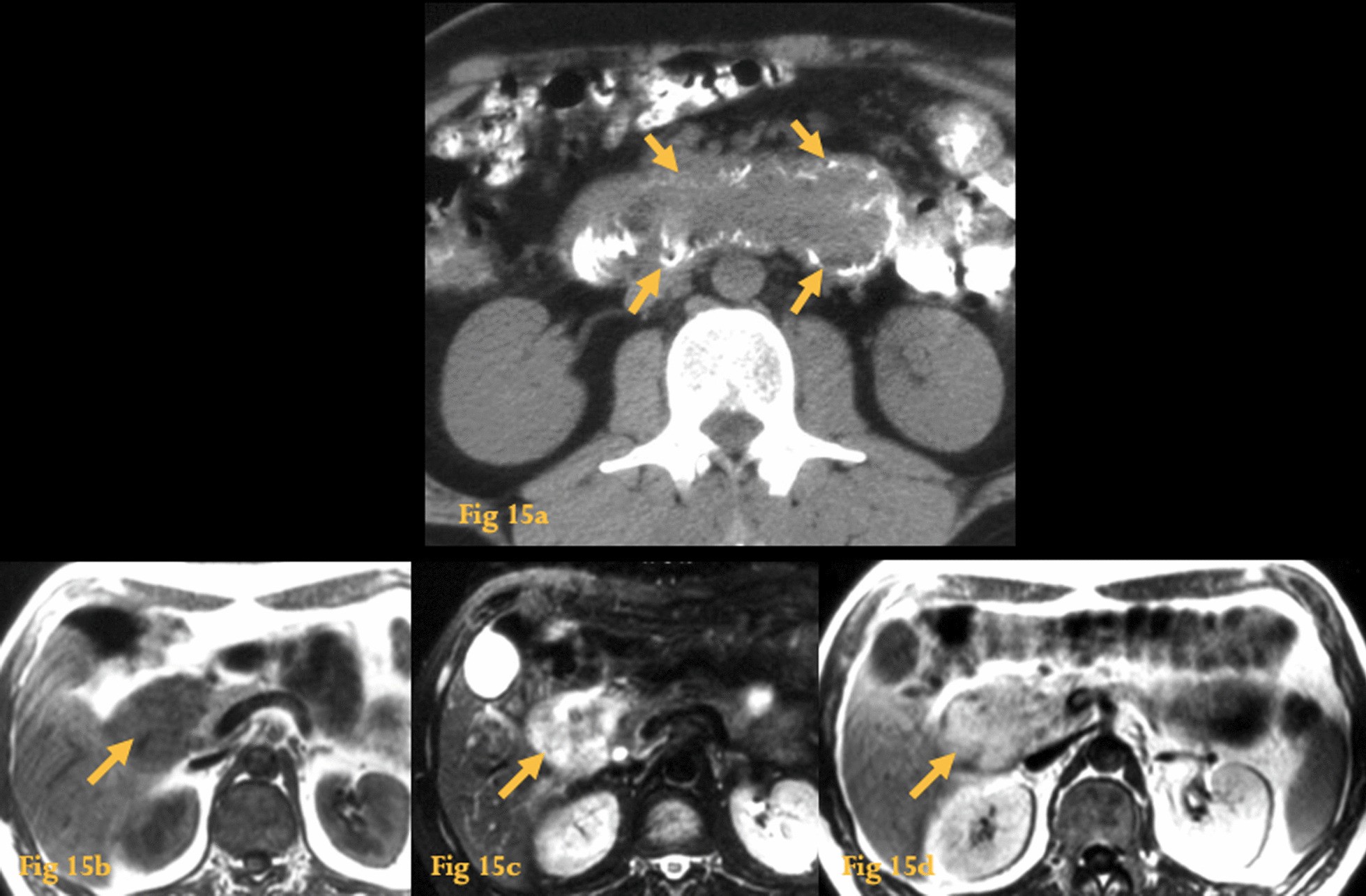 Fig. 15