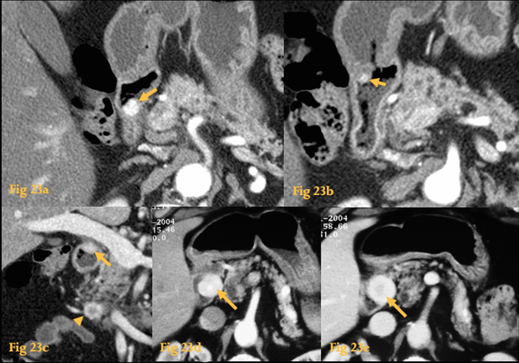 Fig. 23