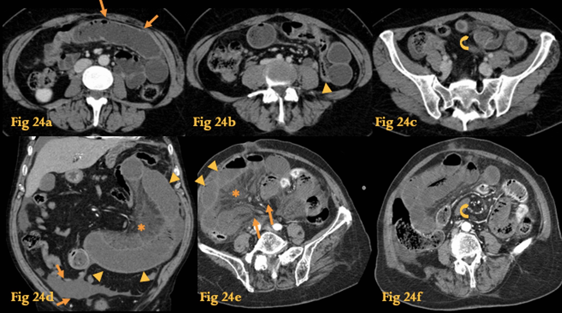 Fig. 24