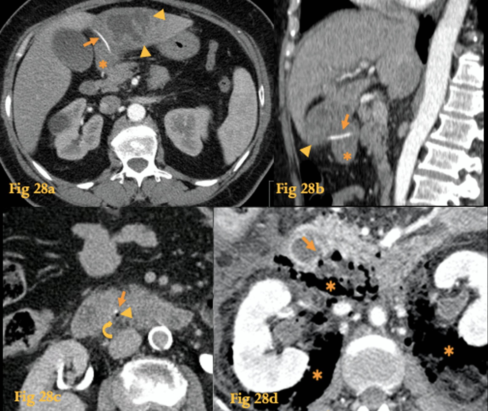 Fig. 28