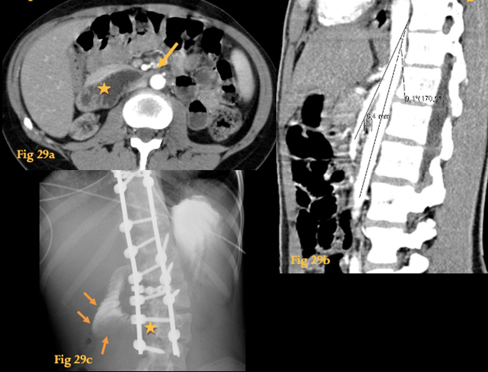 Fig. 29