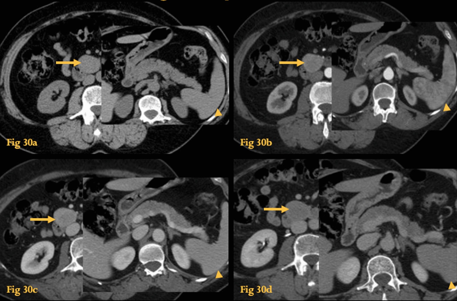 Fig. 30