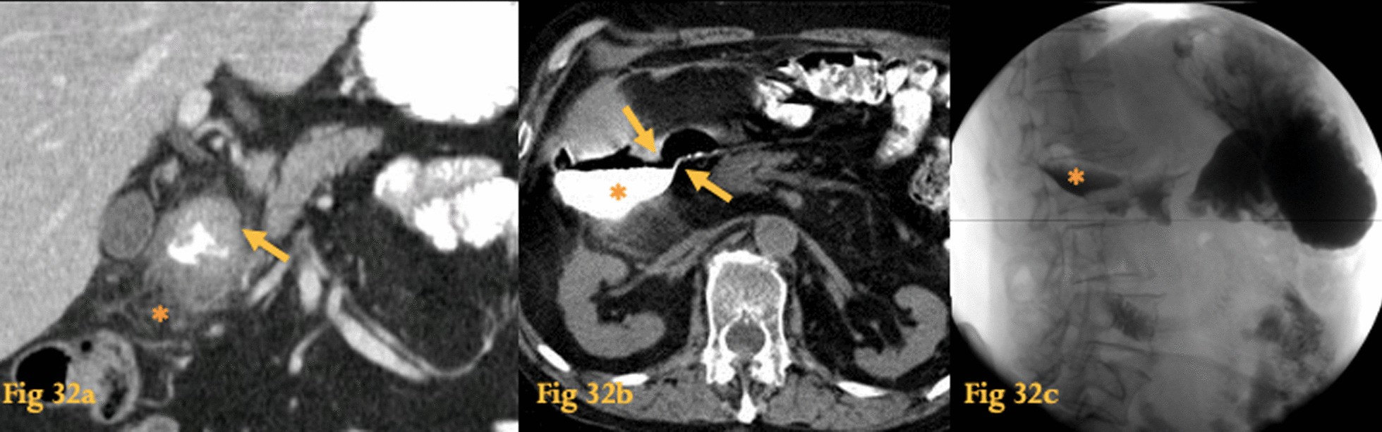 Fig. 32