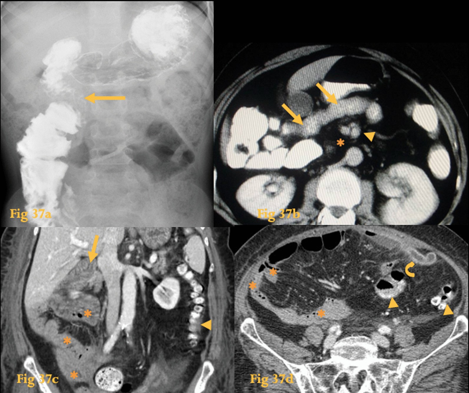 Fig. 37