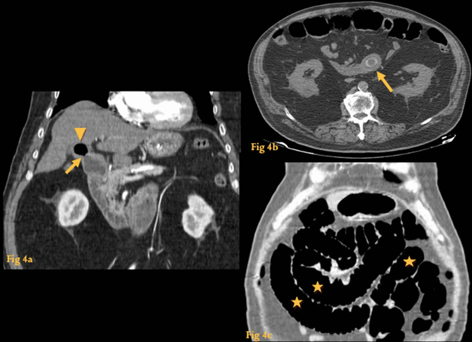 Fig. 4