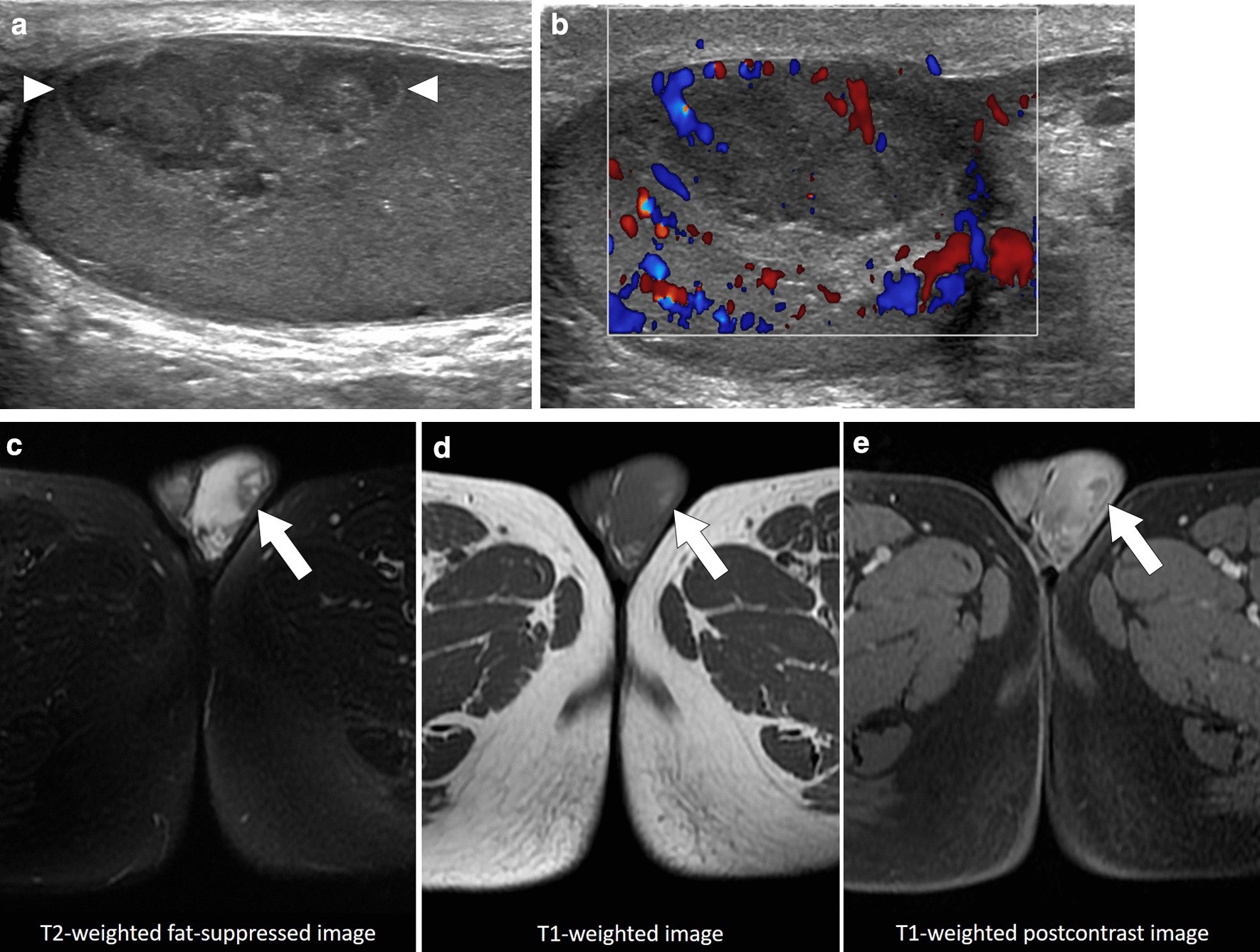 Fig. 15