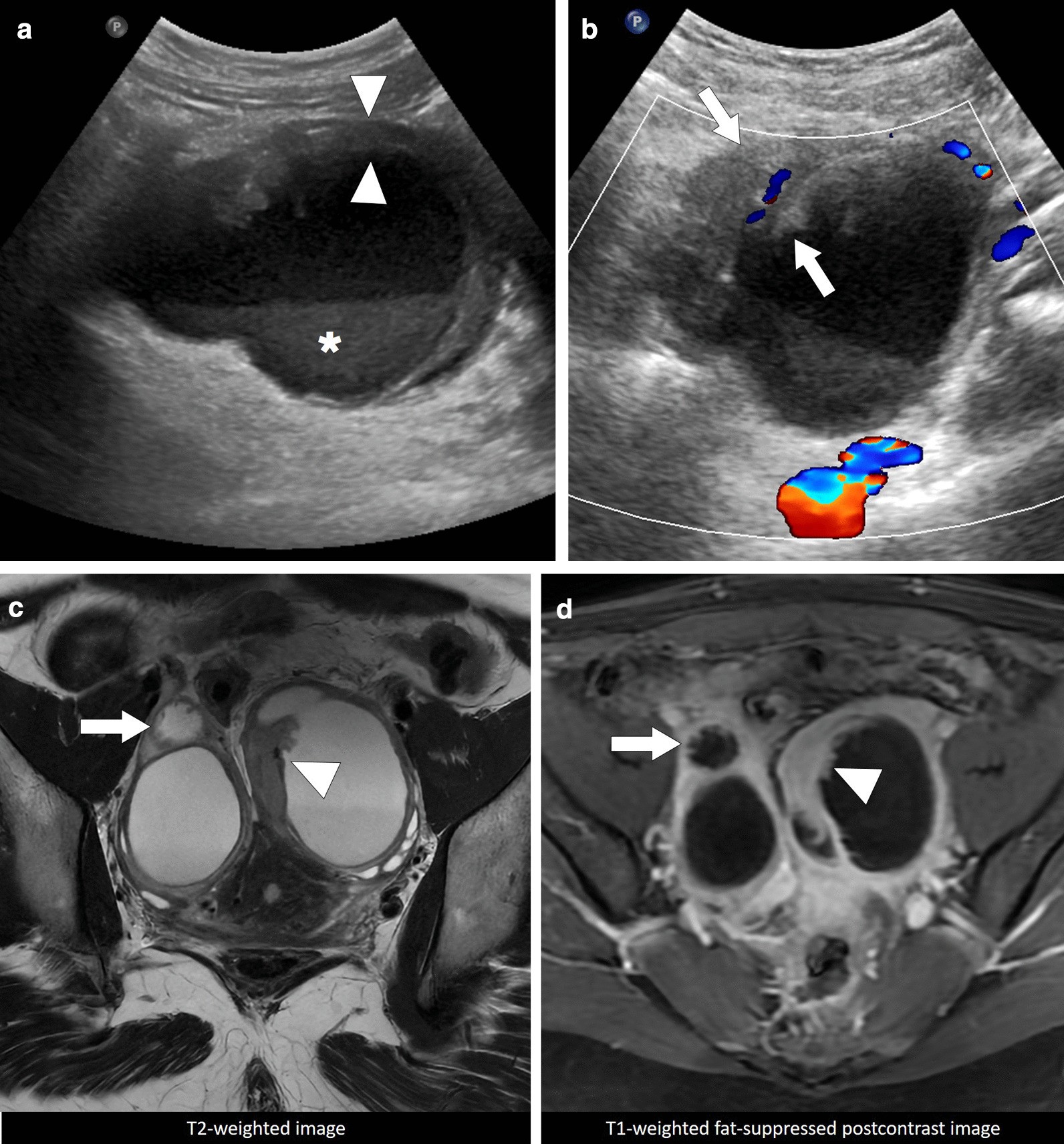 Fig. 26