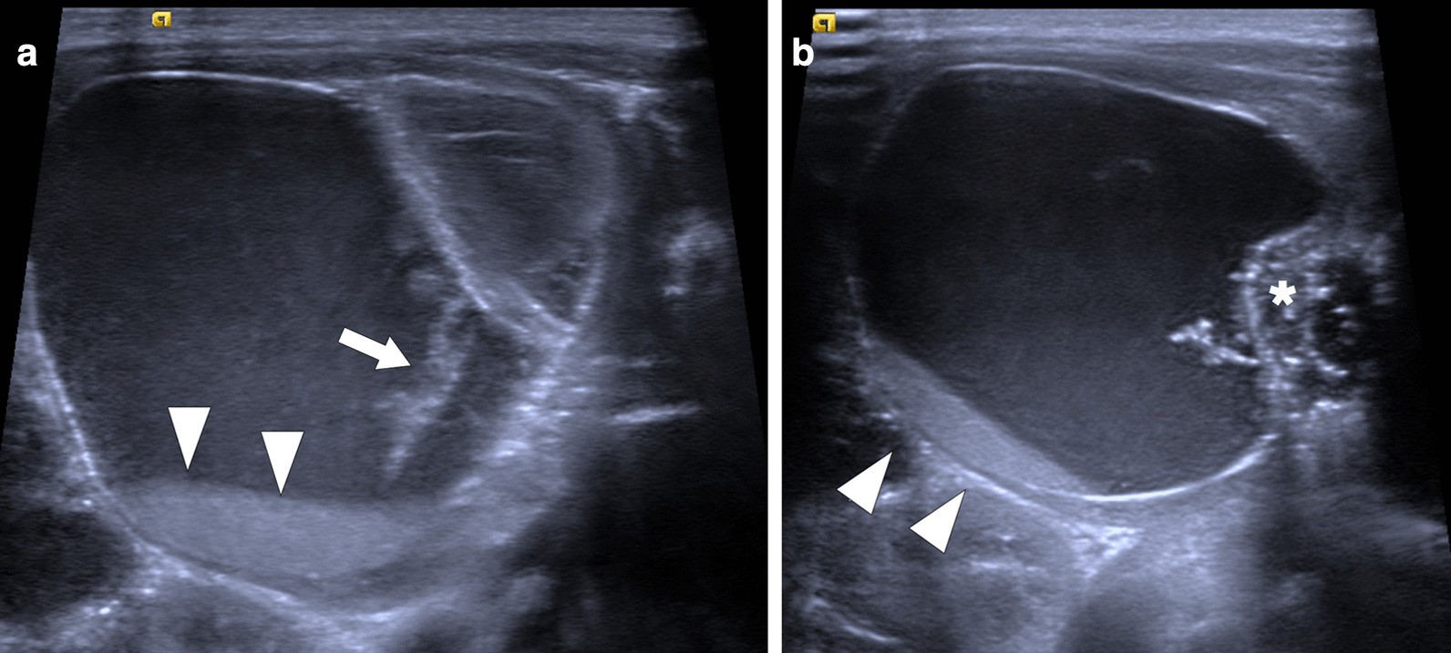 Fig. 31