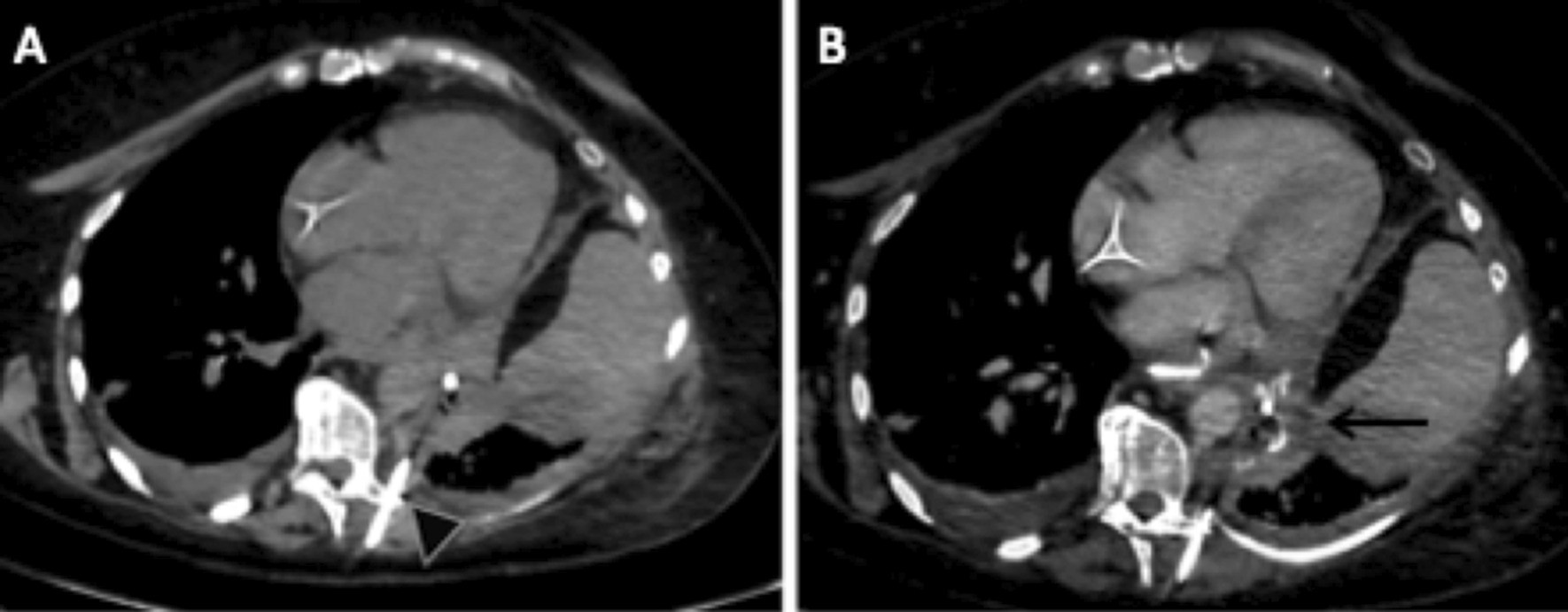 Fig. 13