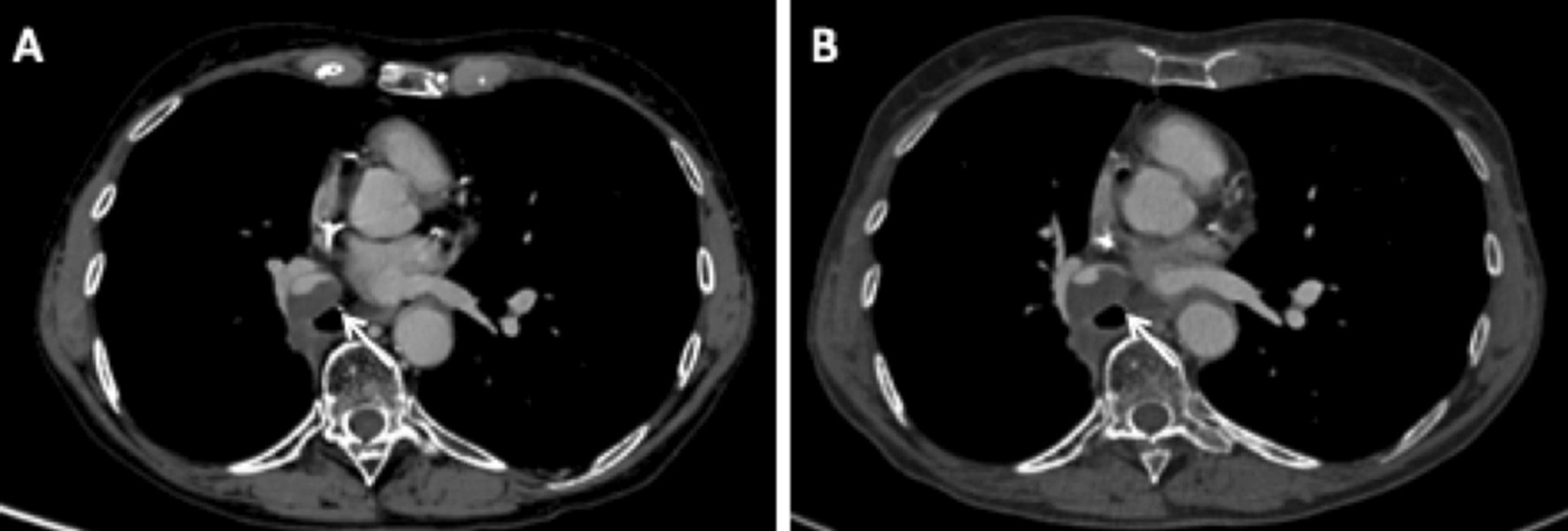 Fig. 14