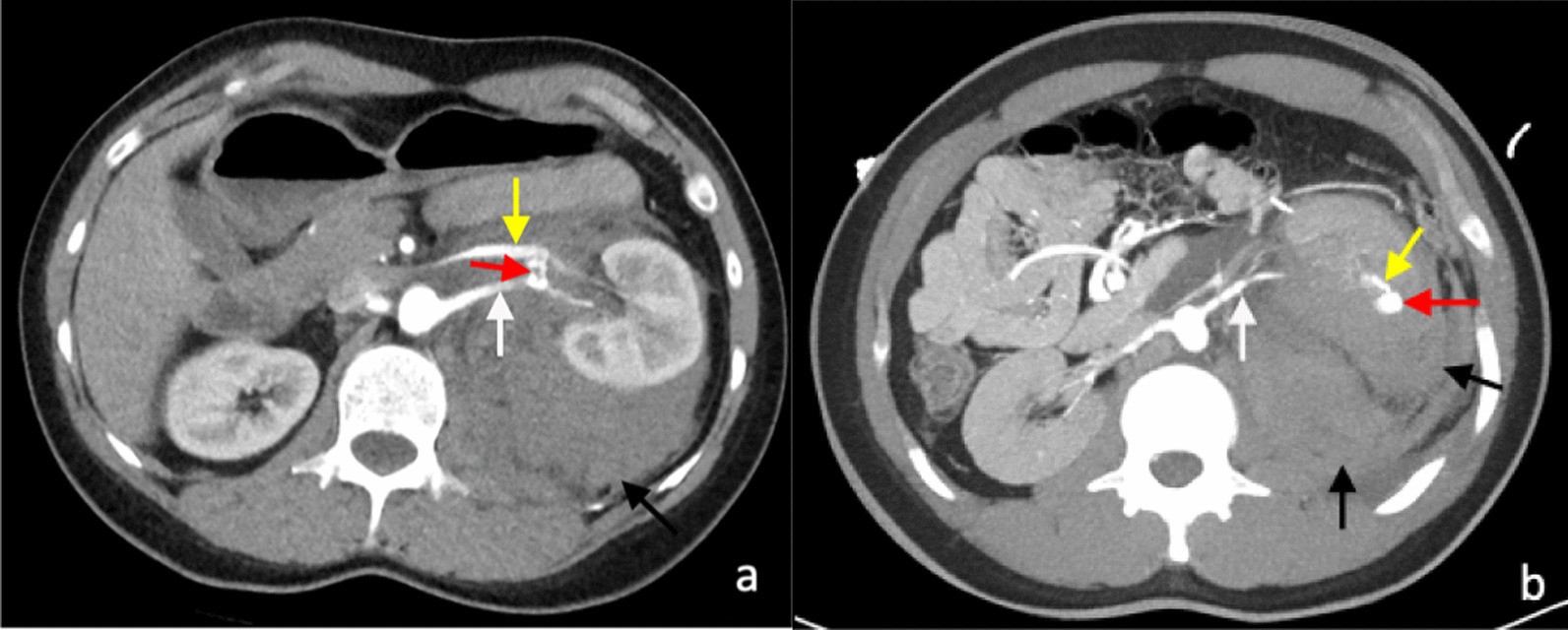 Fig. 12