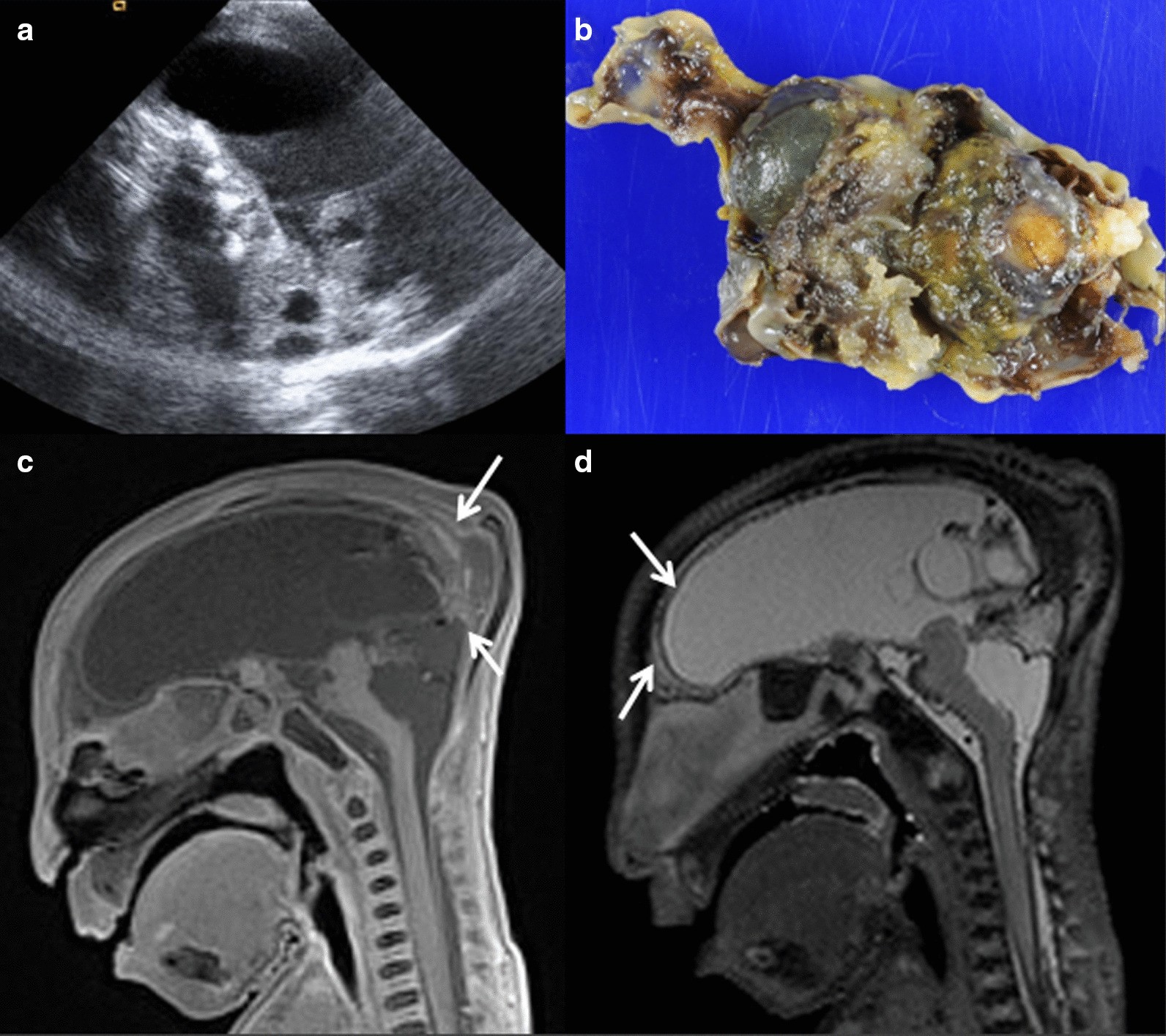 Fig. 11