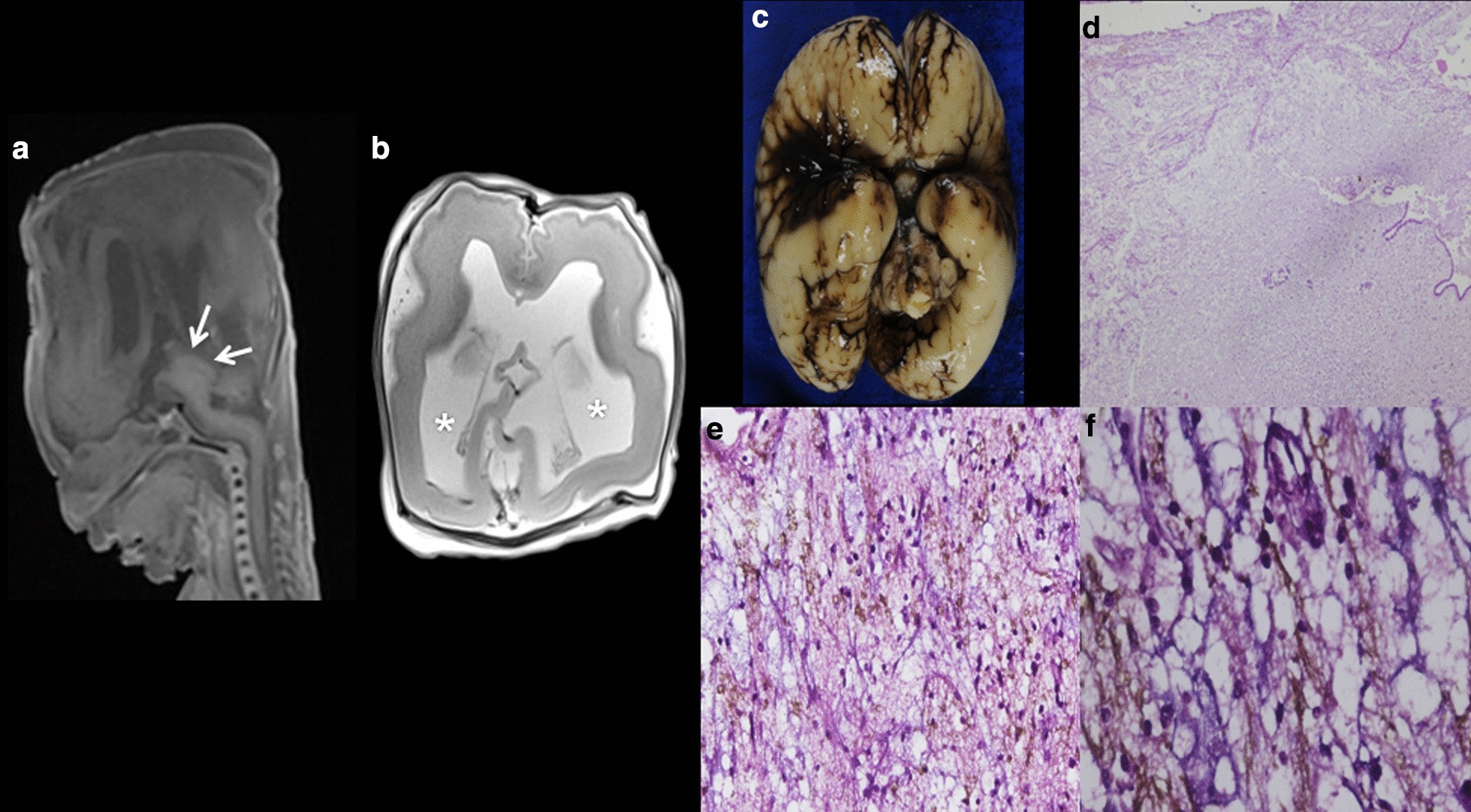 Fig. 12